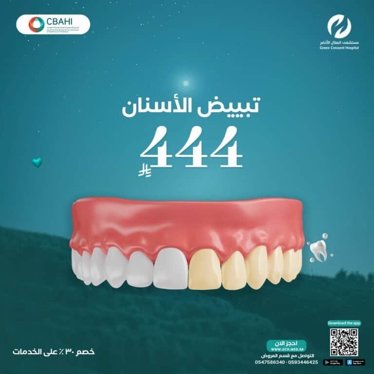 تبييض الأسنان
